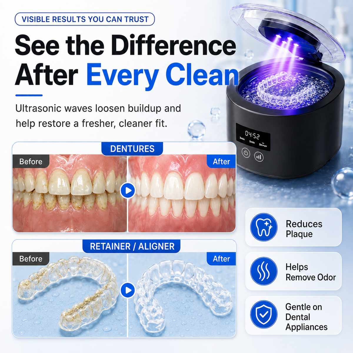 ✨ 50kHz Ultrasonic Denture & Retainer Cleaner – Deep Clean in Just 5 Minutes 🦷💧