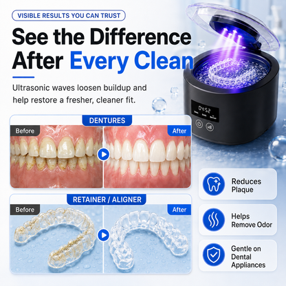 ✨ 50kHz Ultrasonic Denture & Retainer Cleaner – Deep Clean in Just 5 Minutes 🦷💧