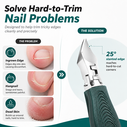 Precision Ingrown Toenail Care Kit™